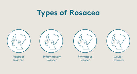 rosacea, types of rosacea, ocular rosacea 