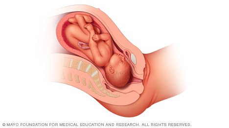 anatomy of baby sitting head first in OP occiput posterior position