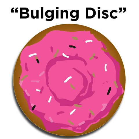 comparing a bulging disc to a jelly doughnut