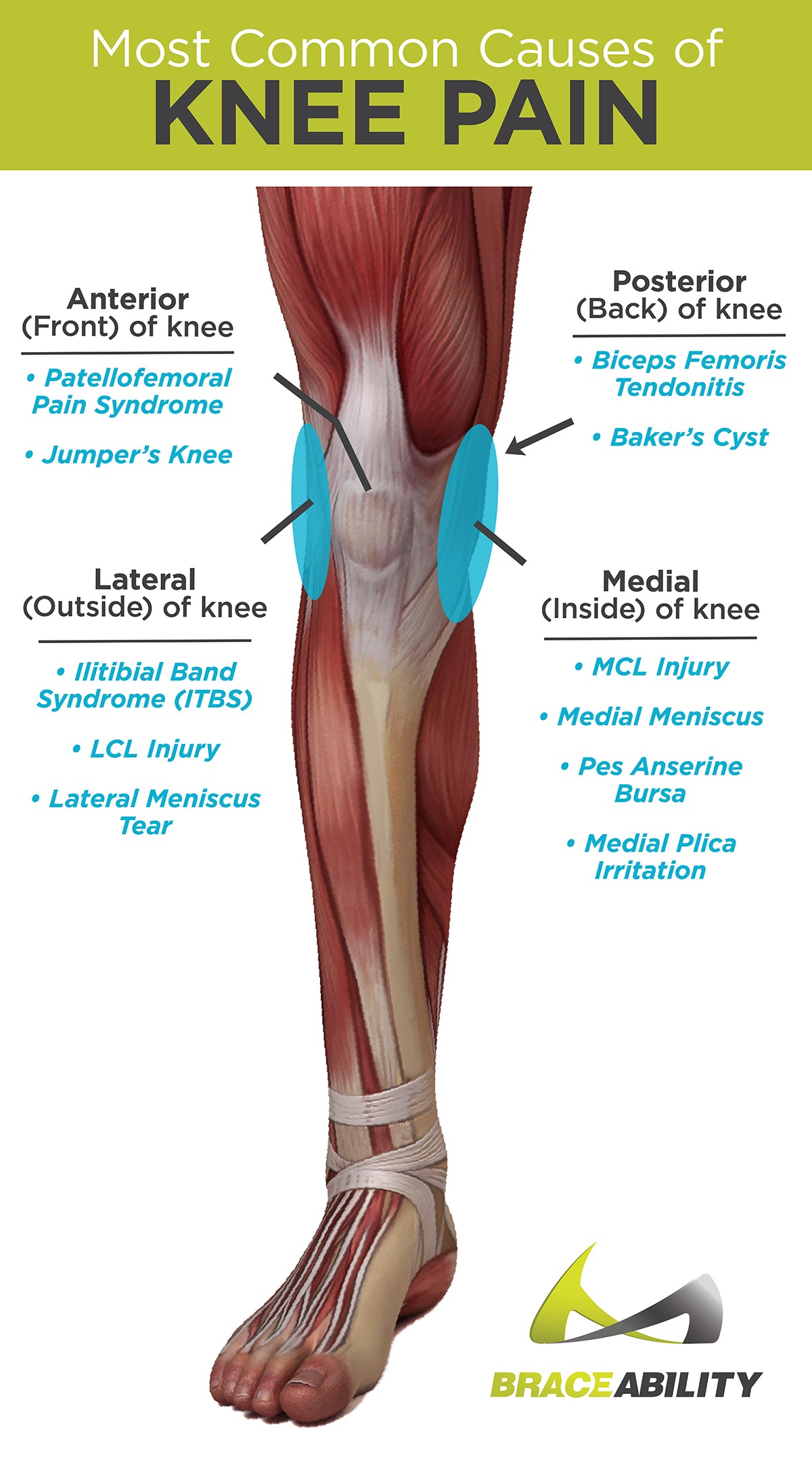 knee pain from sports and what it means