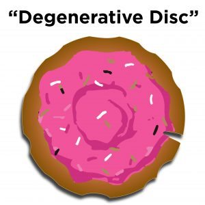degenerative disc with water loss when compared to a jelly doughnut