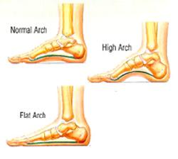 common foot problems include normal, high, and flat arches