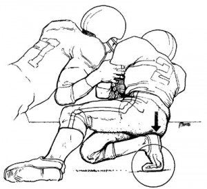 Graphic showing how athletes like football players get lisfranc injuries from over bending their foot