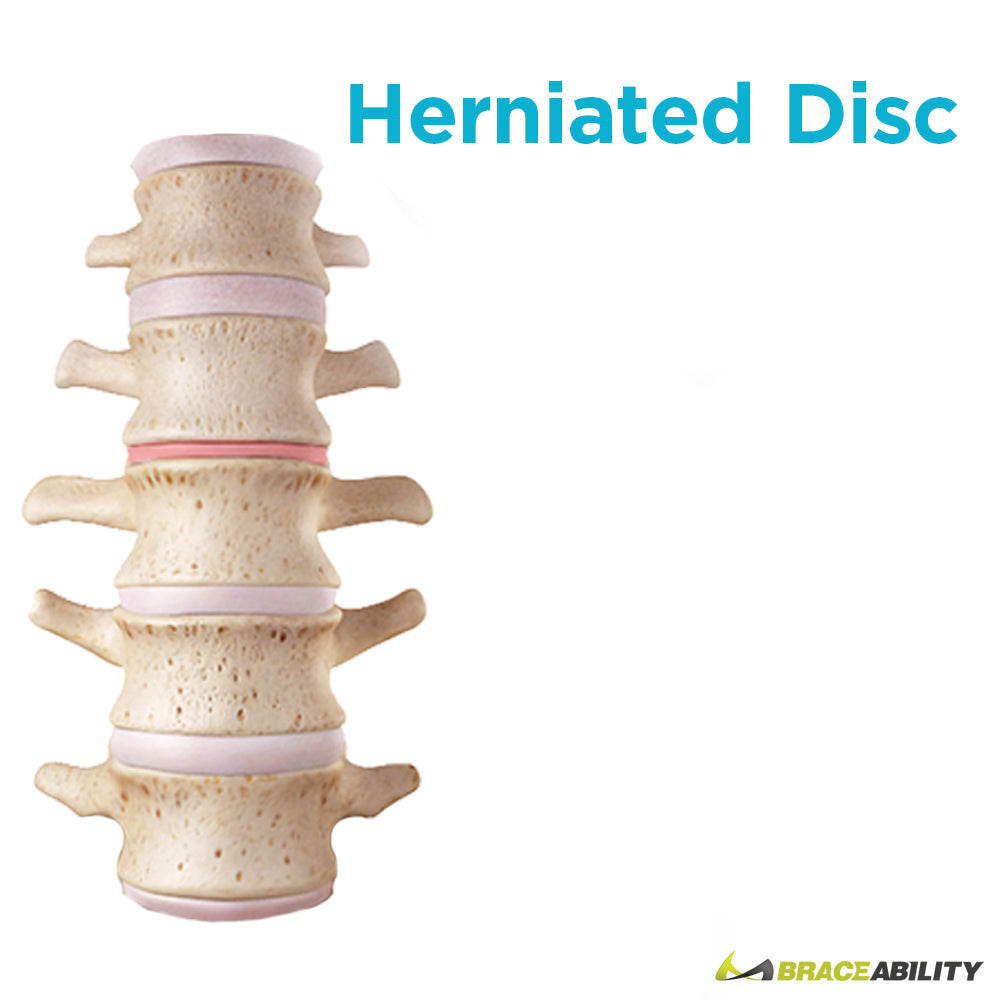 Getting a herniated disc from old age is common, using a TLSO back brace can help eliminate the pain