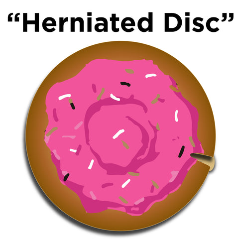 comparing a herniated disc in your back to a jelly doughnut