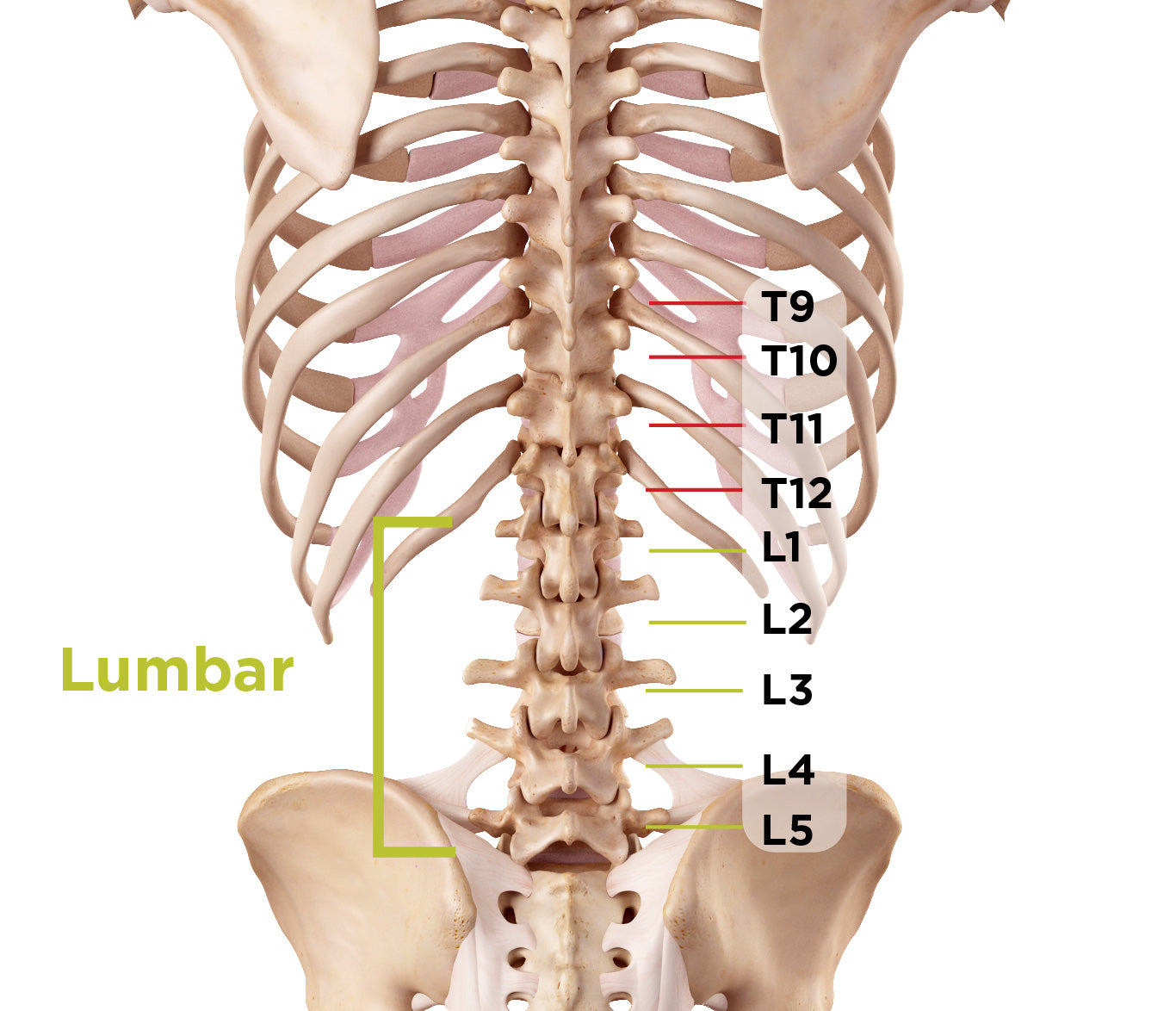 Lumbar back pain from spondylolisthesis and how to treat it with a back brace