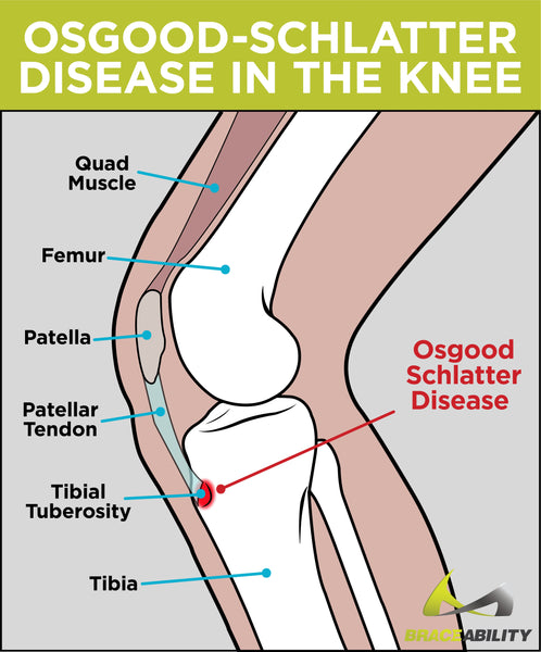 Anatomy of the knee and the tibial tuberosity where osgood-schlatter disease happens