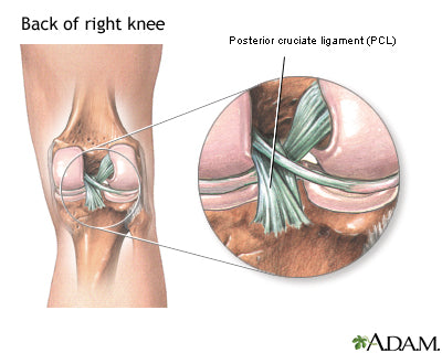 where a pcl injuries happens in the ligaments behind the kneecap