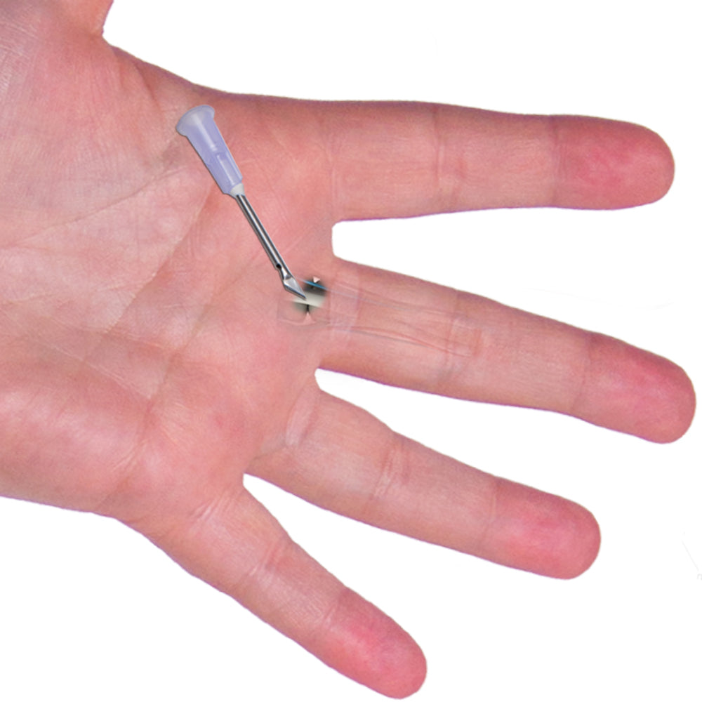 percutaneous surgery for trigger finger or thumb pain