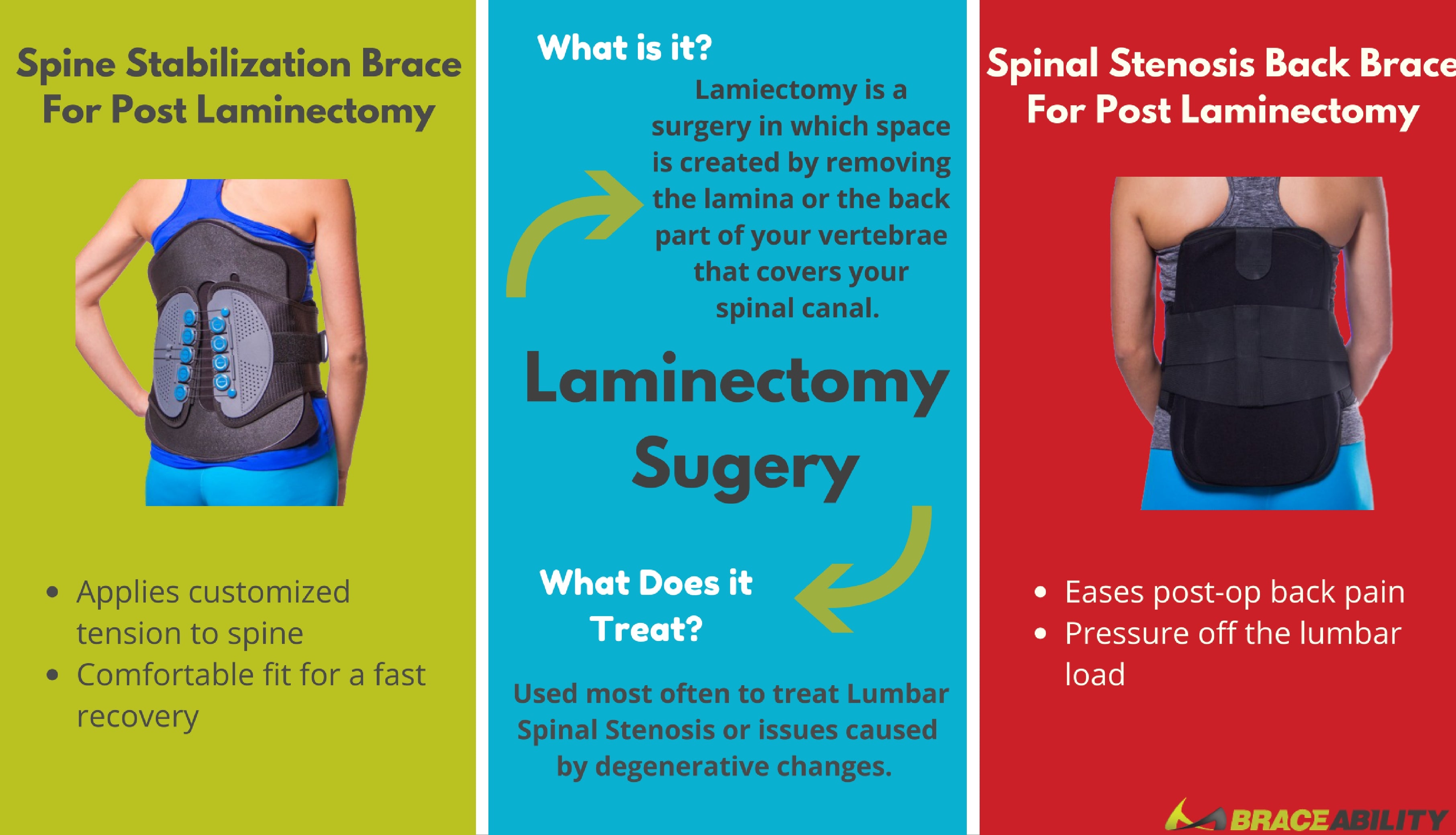 Best treatment option for after lumbar laminectomy surgery