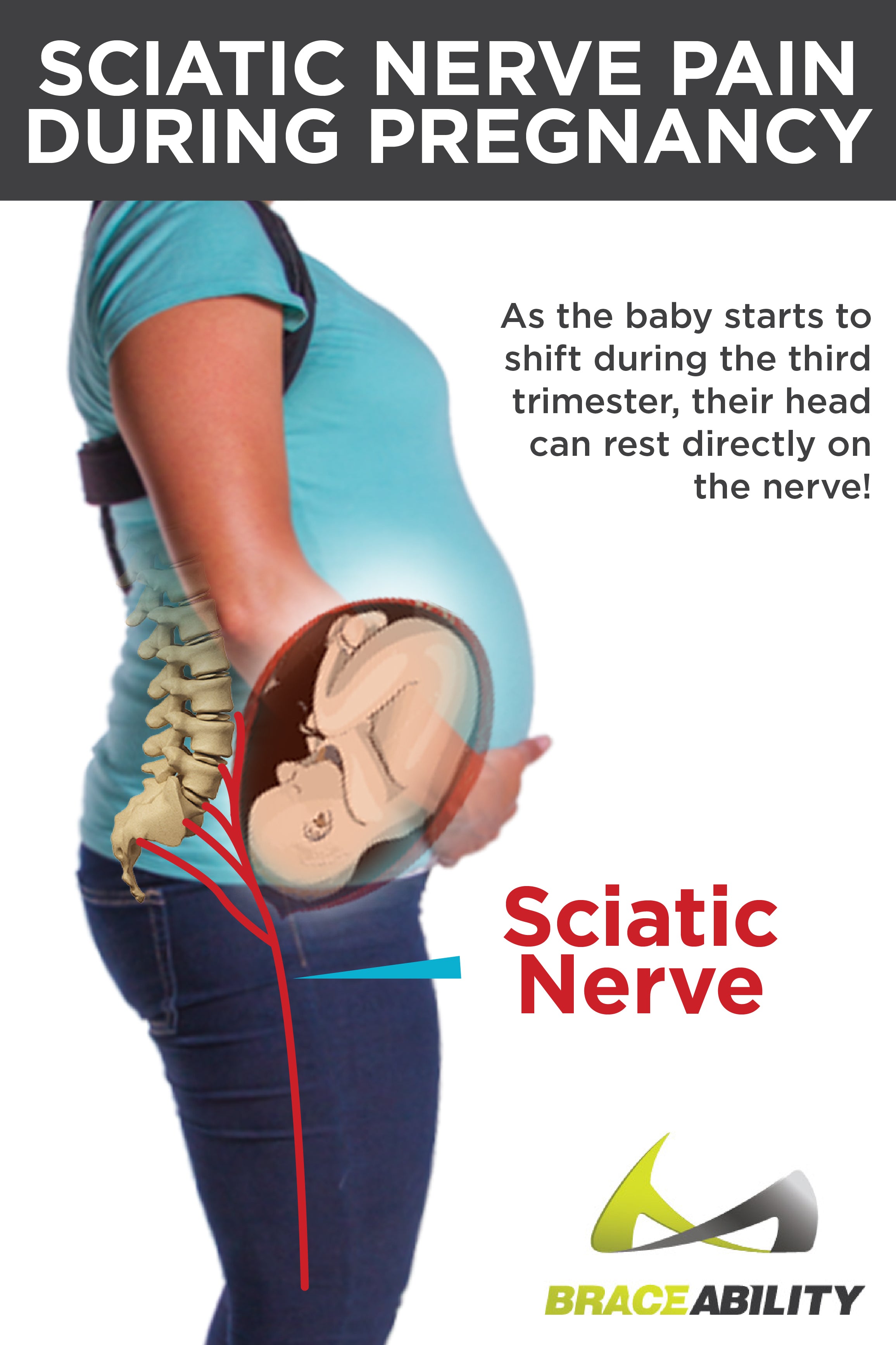 Sciatica pain during pregnancy happens when the baby is on your sciatic nerve