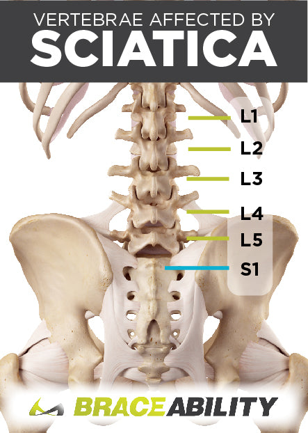 the most common vertebrae affected by sciatica pain in the lower back