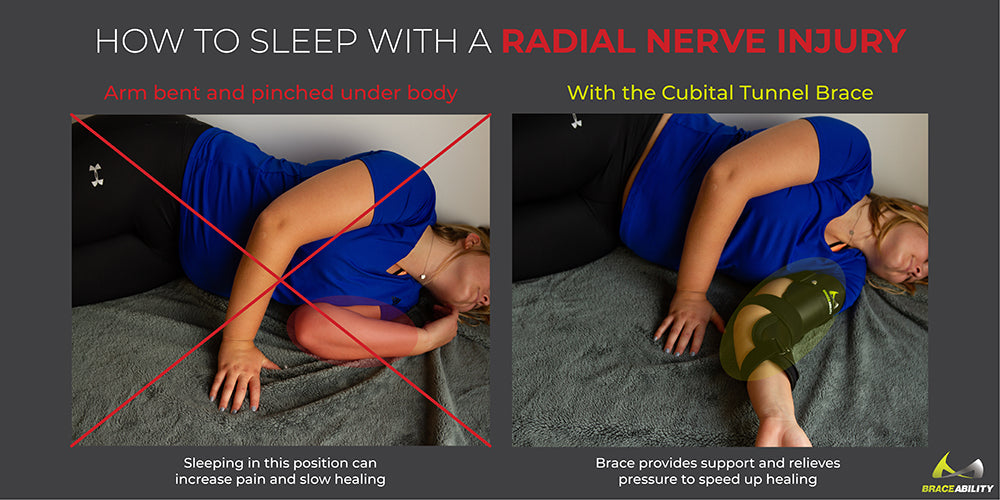 sleeping with a radial nerve injury to reduce pain and heal quickly