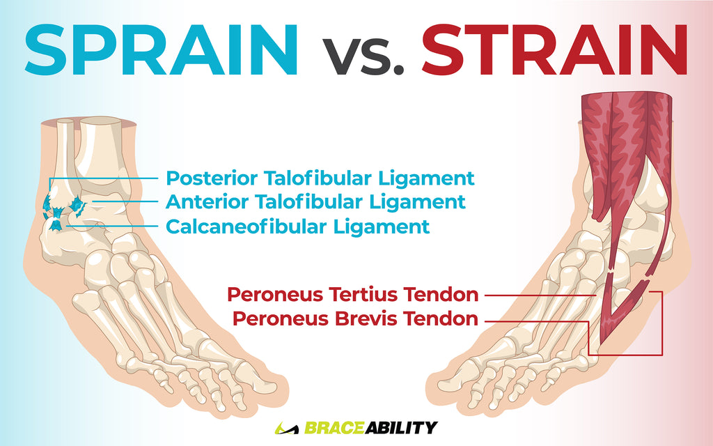 learn the difference between an ankle sprain and strain