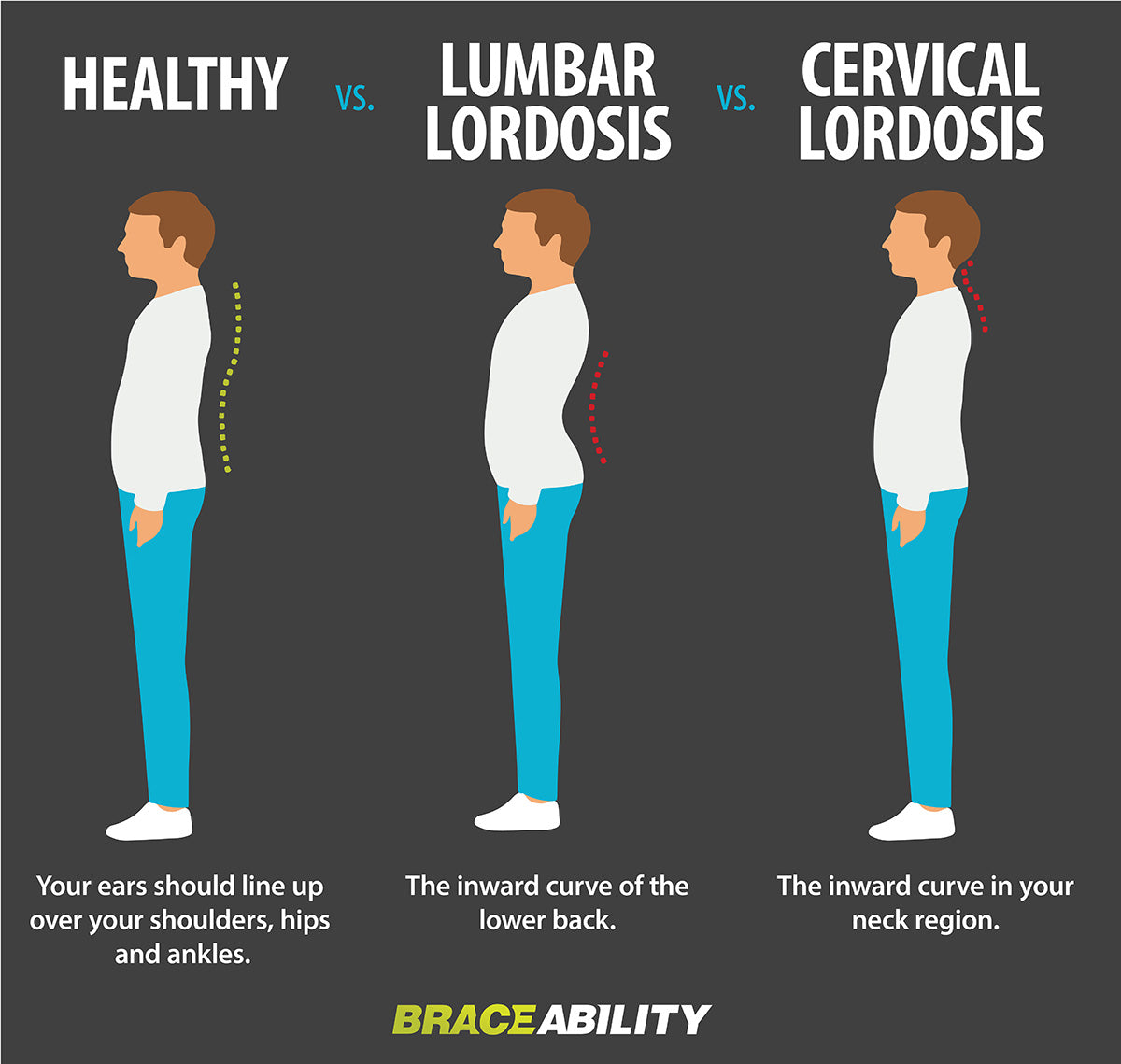 infographic describing the two different types of lordosis in your lumbar and cervical vertebrae