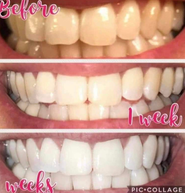 ap24 whitening toothpaste review