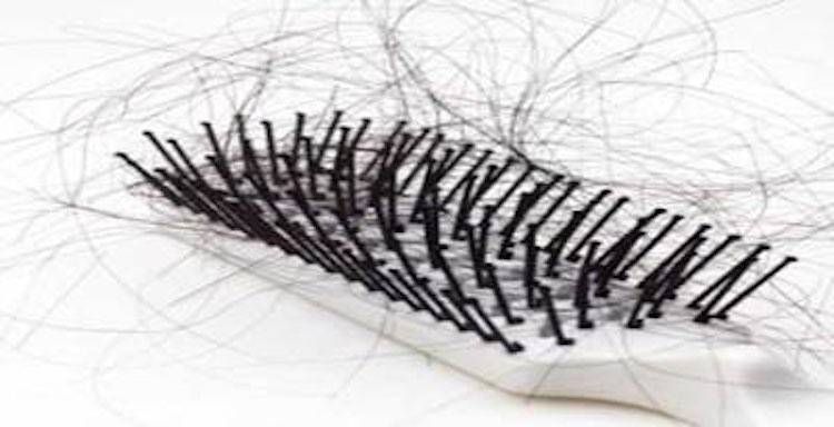 shedding-hair-on-comb