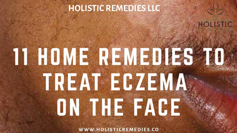 eczema on black facial skin