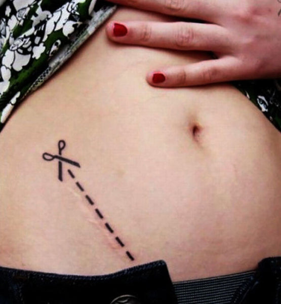 tatouage tatoo tattoo cacher masquer blessure cicatrice tattoo-ephemere tatouage temporaire faux tatouage