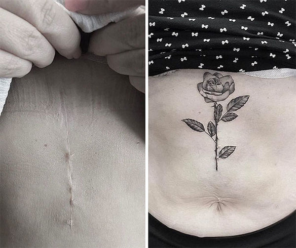 tatouage tatoo tattoo cacher masquer blessure cicatrice tattoo-ephemere tatouage temporaire faux tatouage
