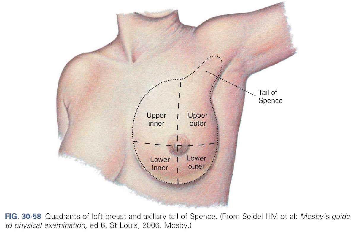 cancro mama mamário mulher