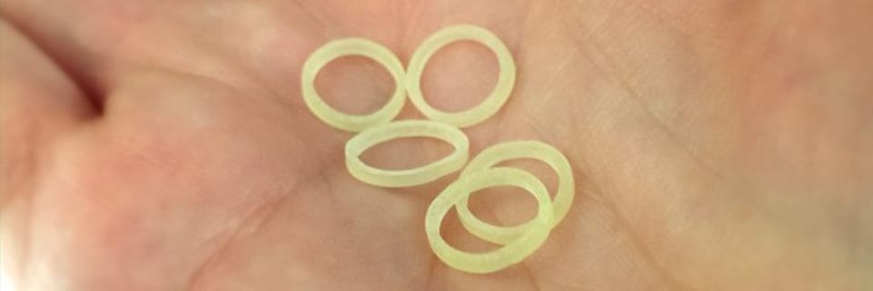 elastic bands for teeth