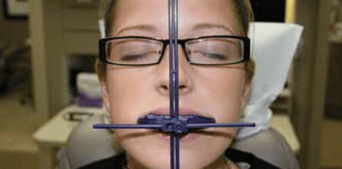 Figure 15: By loosening the screw and sliding the components to the patient’s right, the vertical bar now corresponds to the patient’s facial midline.