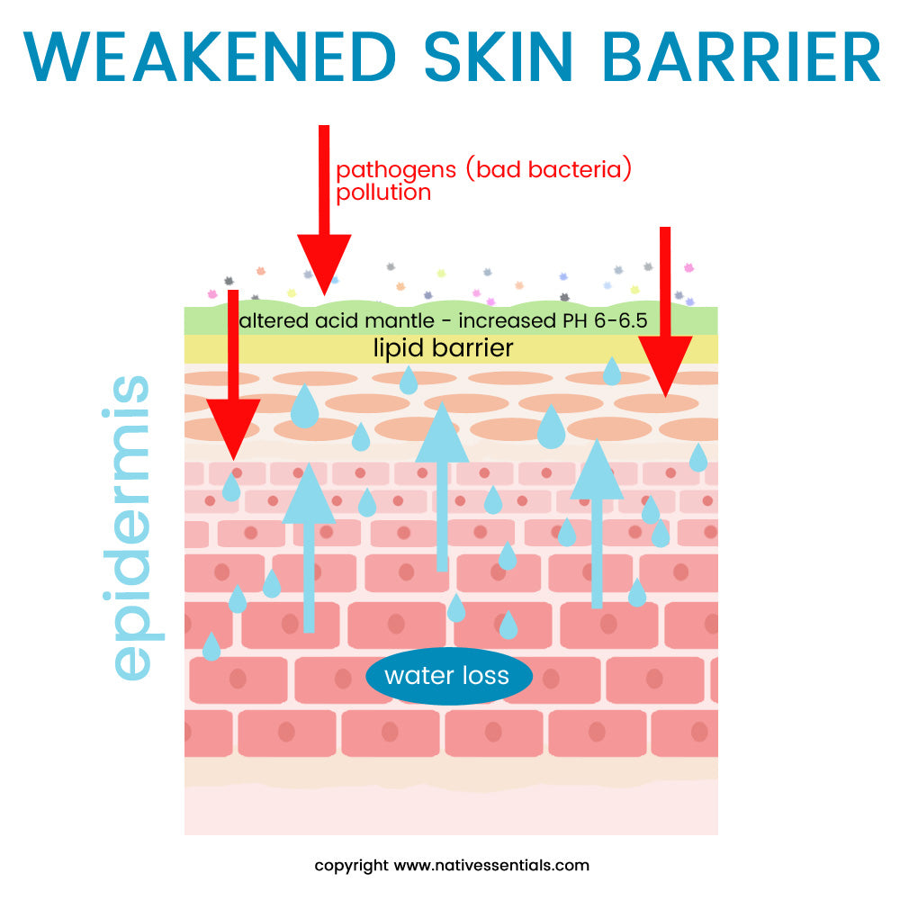 Native Essentials Skincare | Weakened Skin barrier