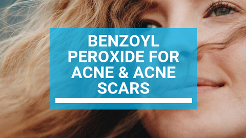 Benzoyl Peroxide For Acne Acne Scars Misumi Luxury Beauty Care