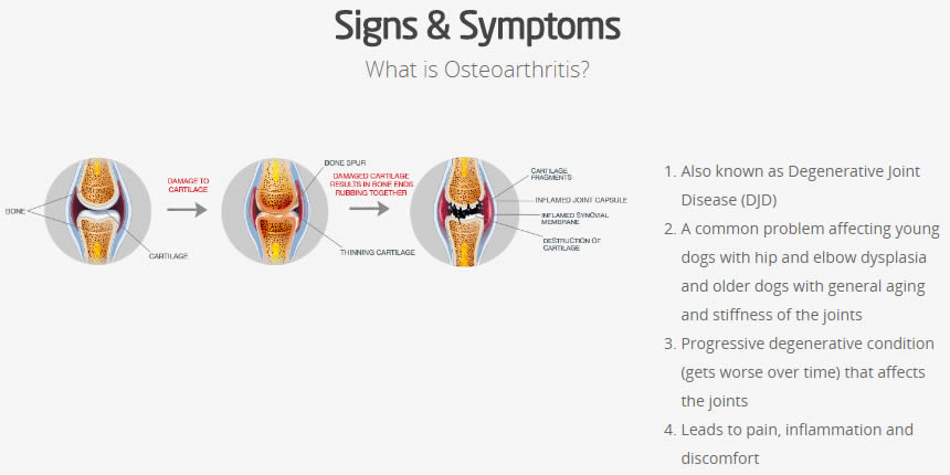 Signs & Symptoms of Osteoarthritis