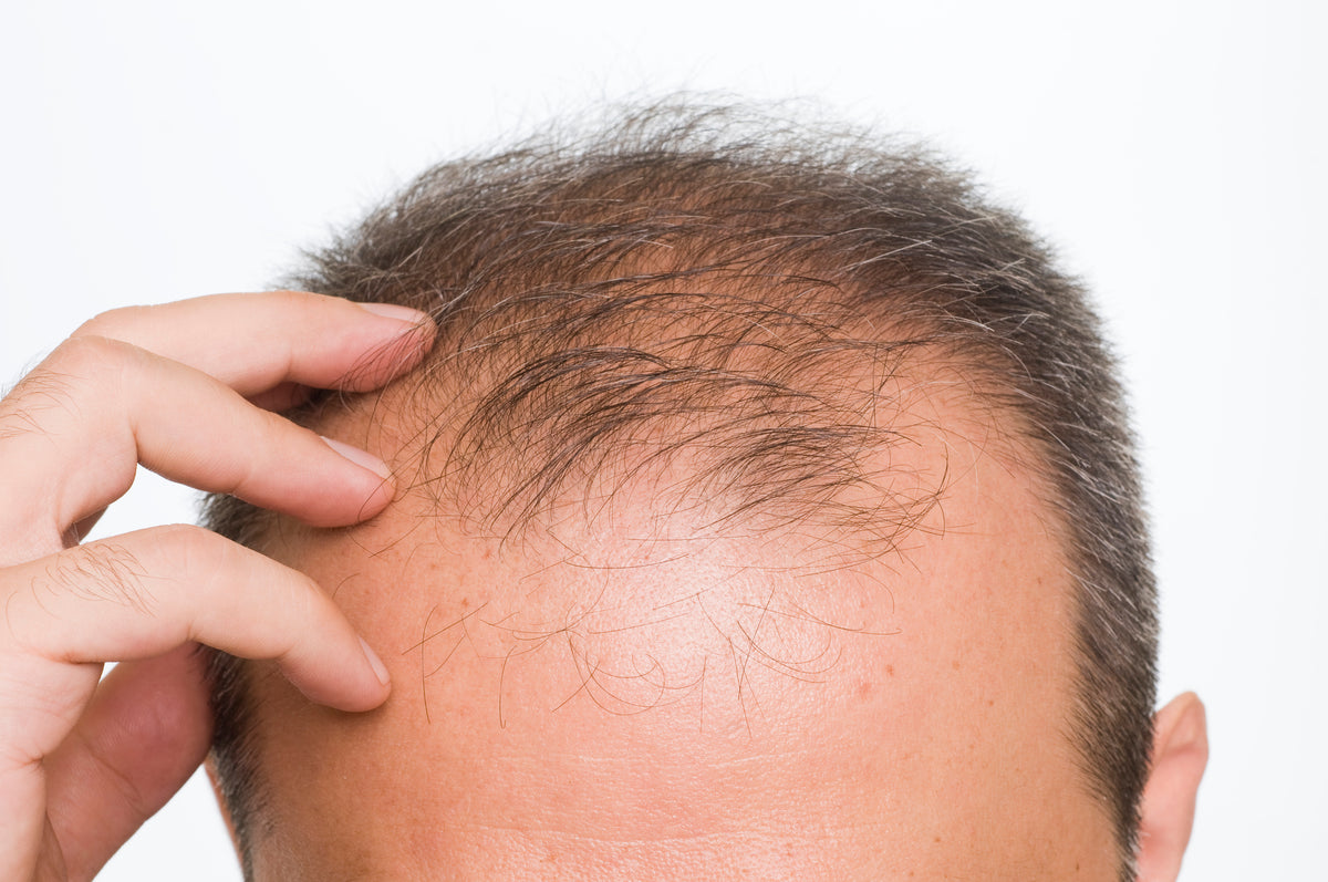 Finasteride vs Tamsulosin for Hair Loss – DS Healthcare Group