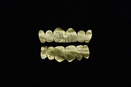 gold-teeth3-copy.jpg