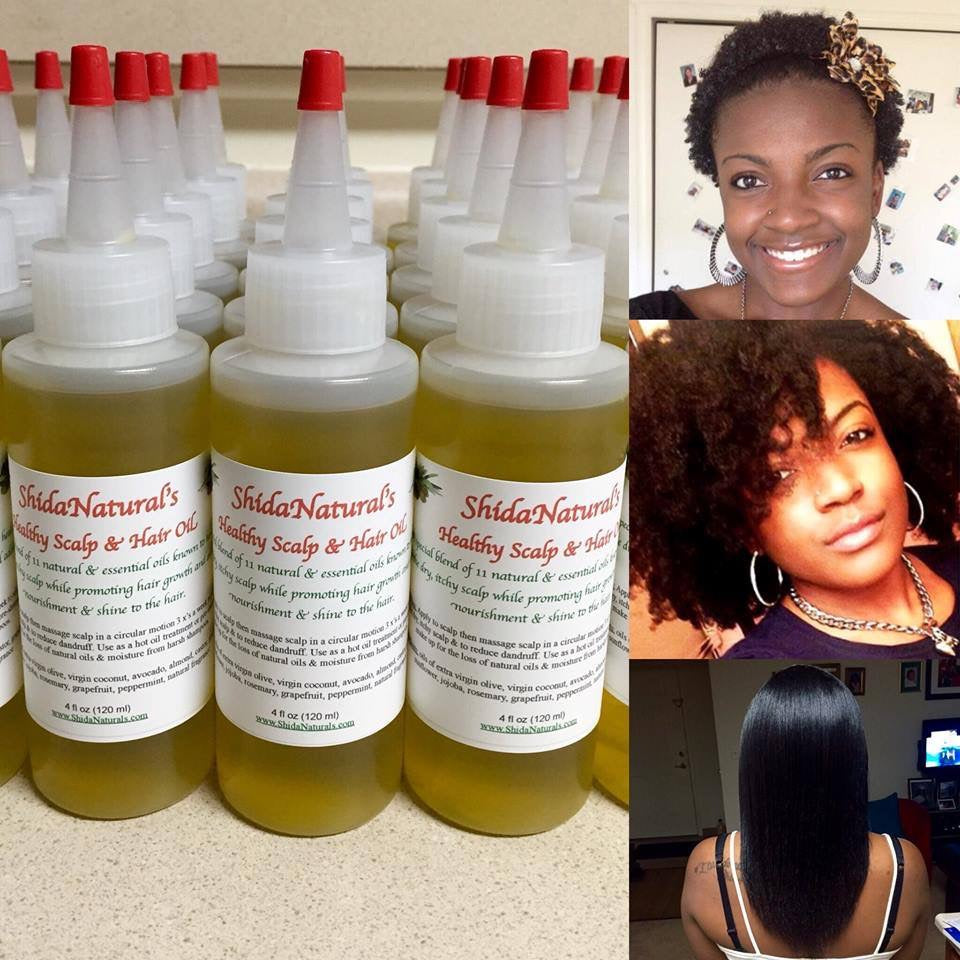 Healthy Scalp & Hair Growth Oil 4 oz (113 g) – ShidaNatural's Healthy Hair  Care Products, LLC