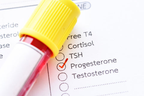 Progesterone Levels