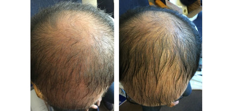 more naturally progress