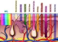 laser wavelengths at The Body Barber™