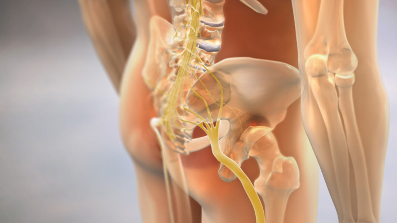 Pinched Nerve Hip? Everything to About & Prevention – The Amino