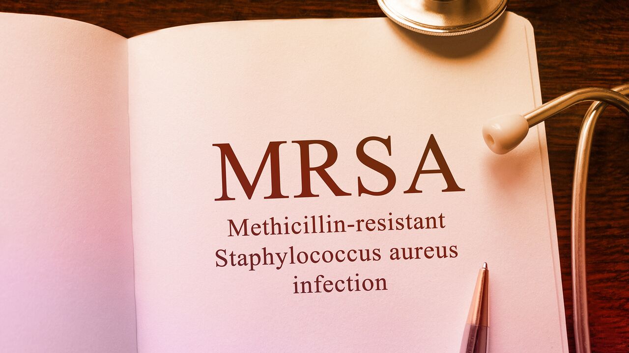 Mrsa Staph Infection What You Need To Know 