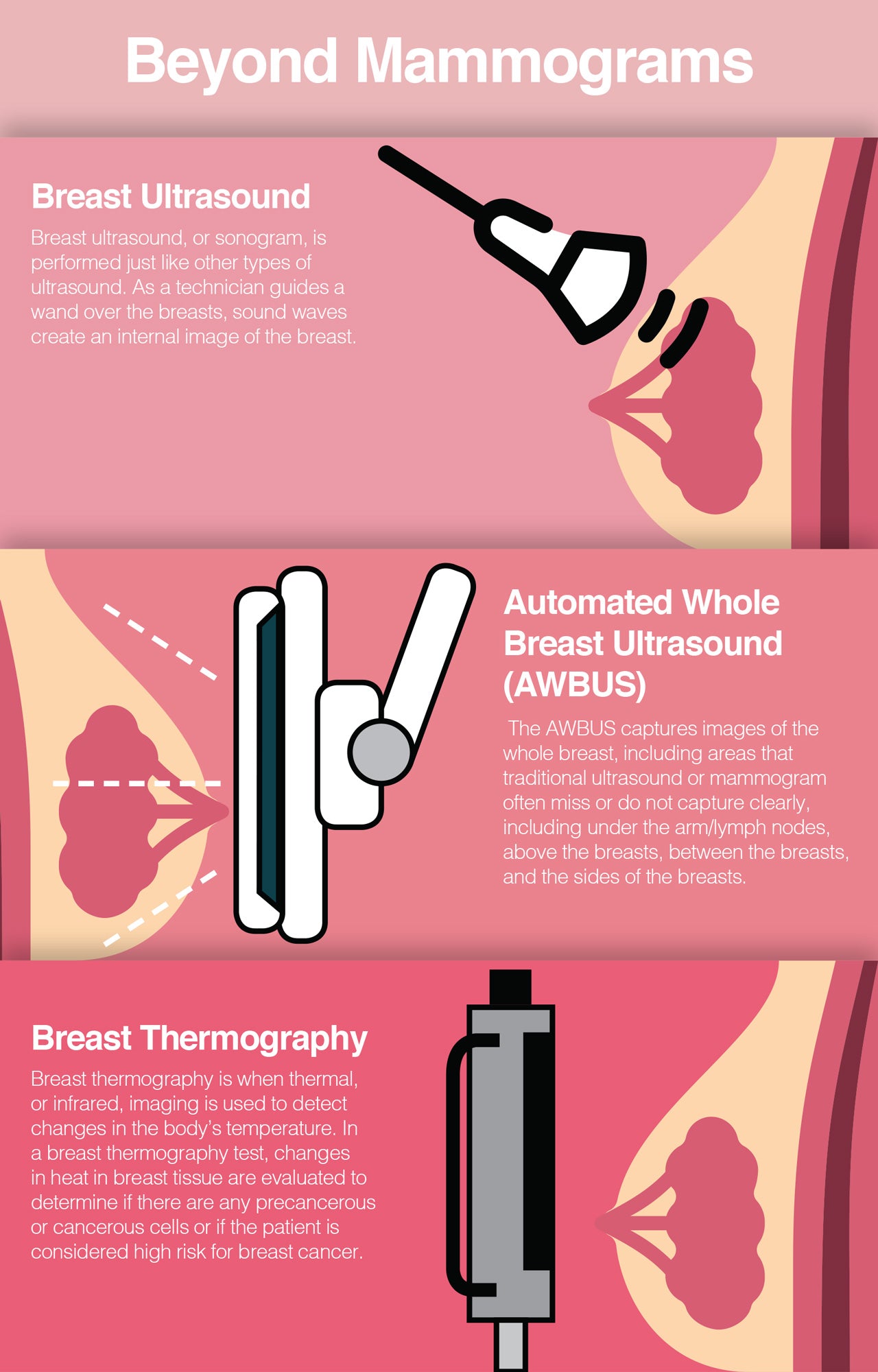 Beyond mammogram