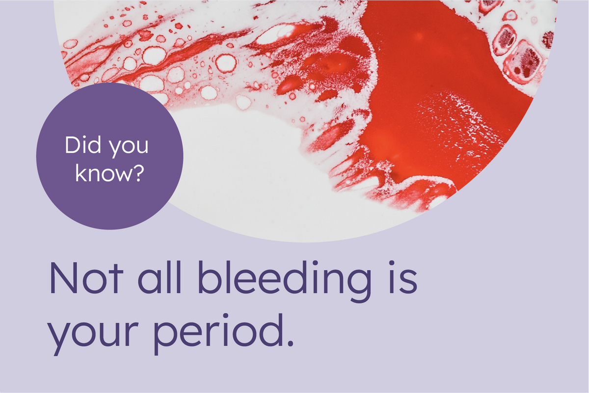 Do You Always Retain Water On Your Period