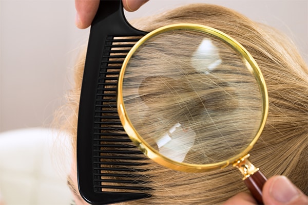 What Do Lice Look Like In Blonde Hair And Ways To Remove Them