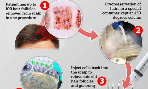hairclone hair follicle stem cell multiplication