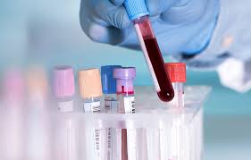 finasteride blood test