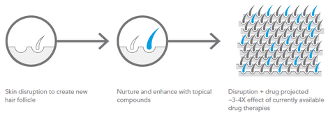 follica hair growth