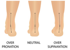 over pronation supination valgus varus foot pathology