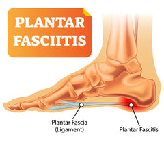plantar fasciitis fascia ligament pain