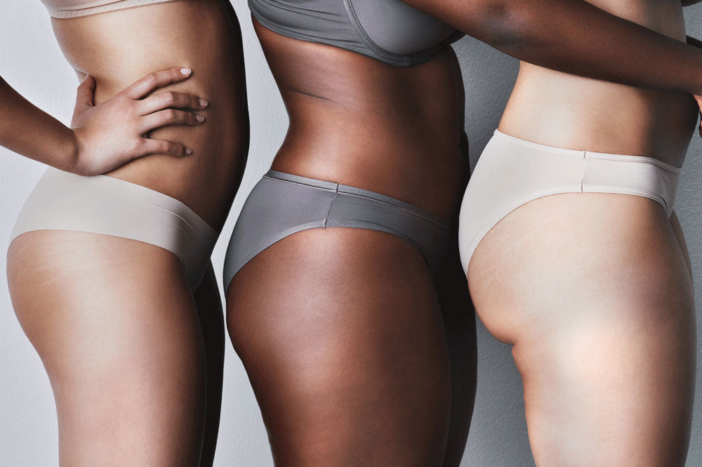 Diverse group of women in undergarments, showing healthy skin