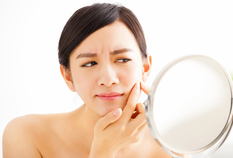 Anti-Acne Skin Care