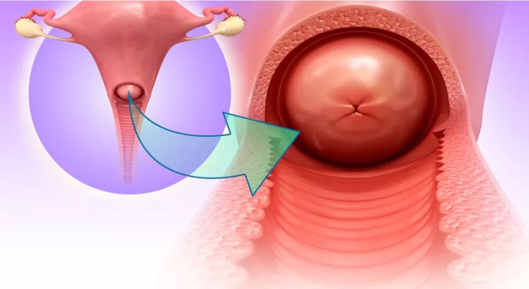 ¿La copa menstrual se puede quedar dentro? (forma del cérvix)