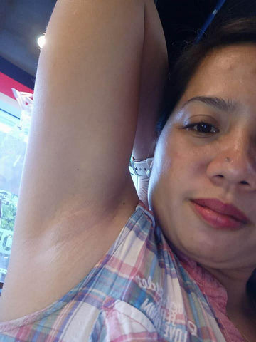 " Look at the proof! Nahihiya ako sa kili-kili ko before at hindi ako makapag-sleeveless. Mula ng gamitin ko ang K Magic Skin Cream, eto ang naging resulta! Ang saya-saya ko talaga! May confidence na ako mag sleeveless at bathing suit. Thank you sa K Magic Skin cream, Ms. Korina Sanchez." 